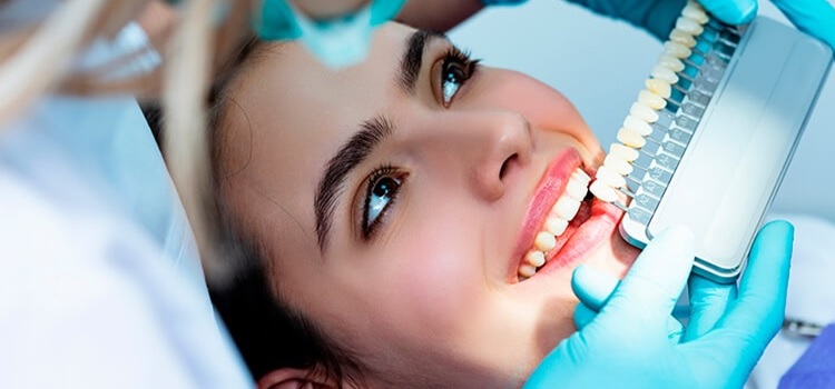 imagen de blanqueamiento dental